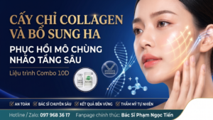 Vai trò của cấy chỉ collagen và HA trong liệu trình combo trẻ hóa 10D bác sĩ Phạm Ngọc Tiến